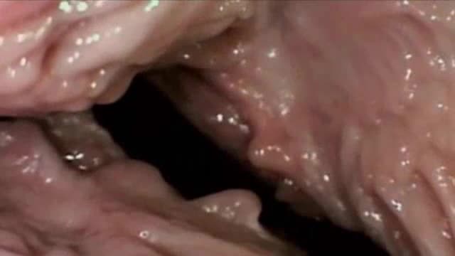 See Inside The Vagina During Sex XXXBunkercom Porn Tube